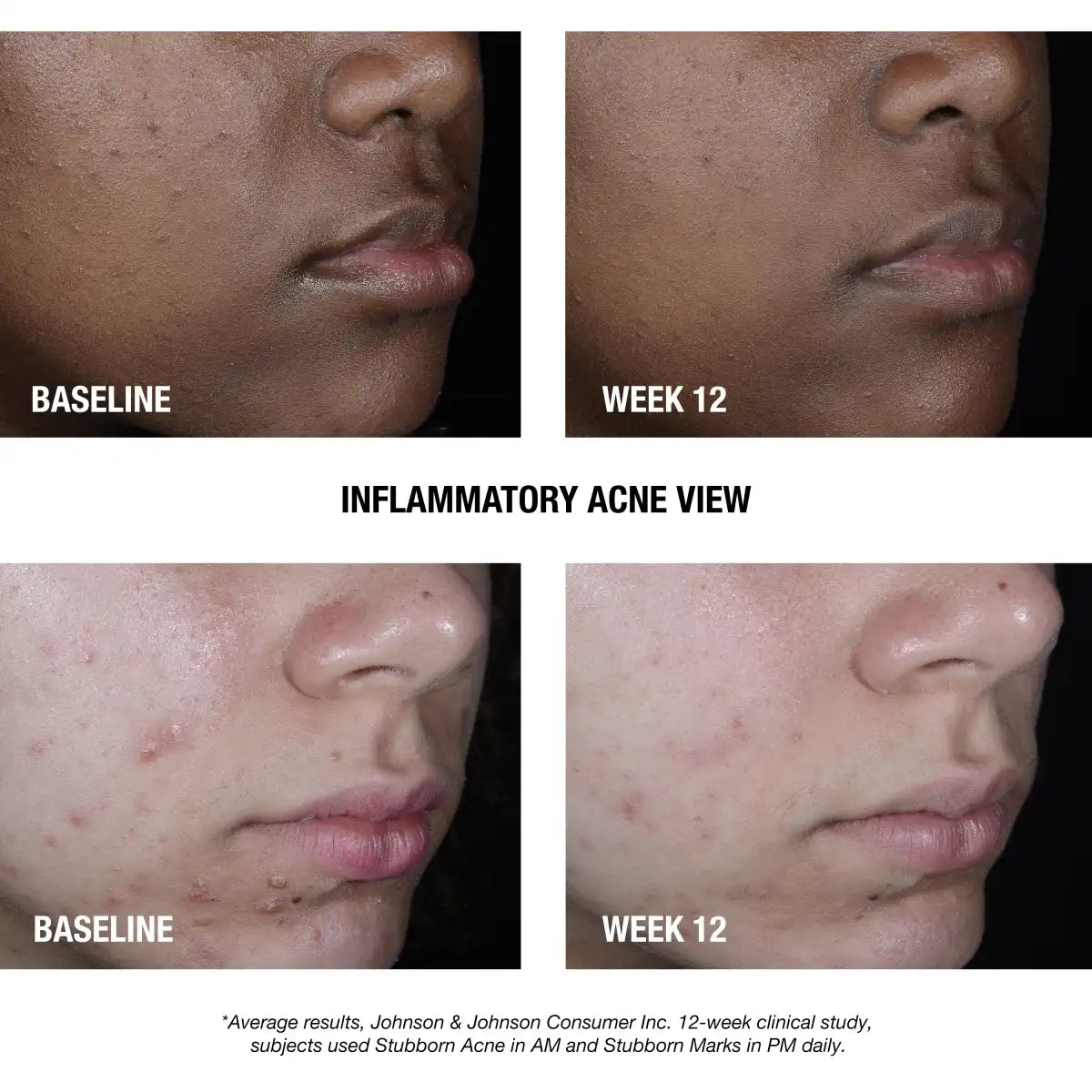 neutrogenashop.us.com